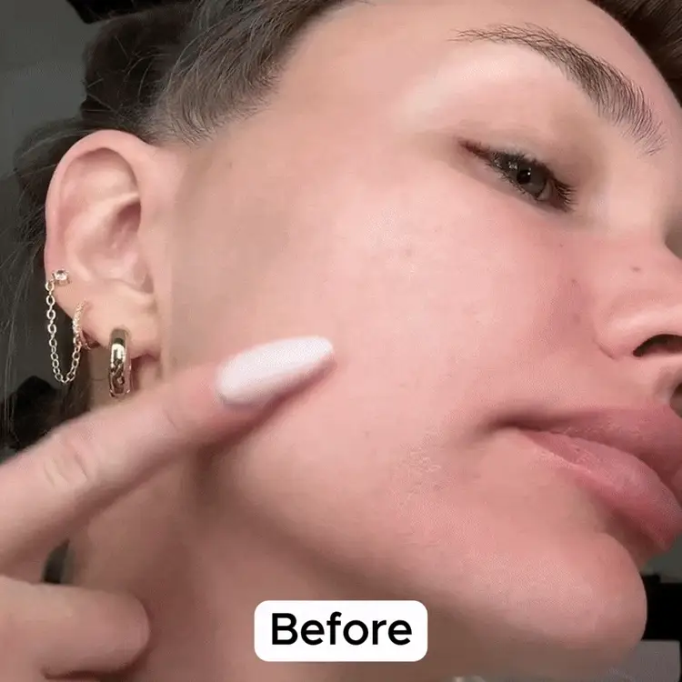 Before After