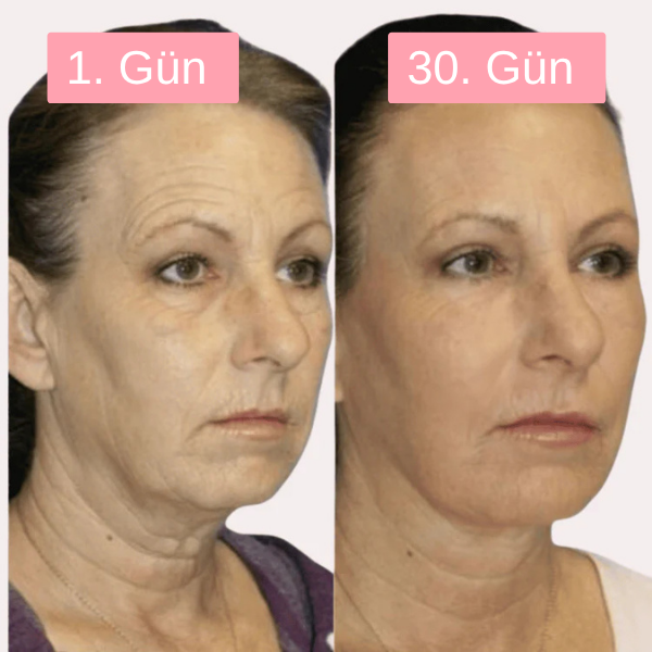 1. Gün - 30. Gün
